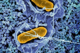 沙门氏菌：致病效应和预防方法